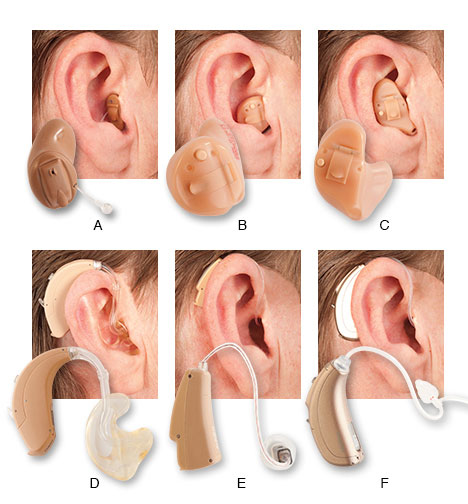 Buy the best hearing aid