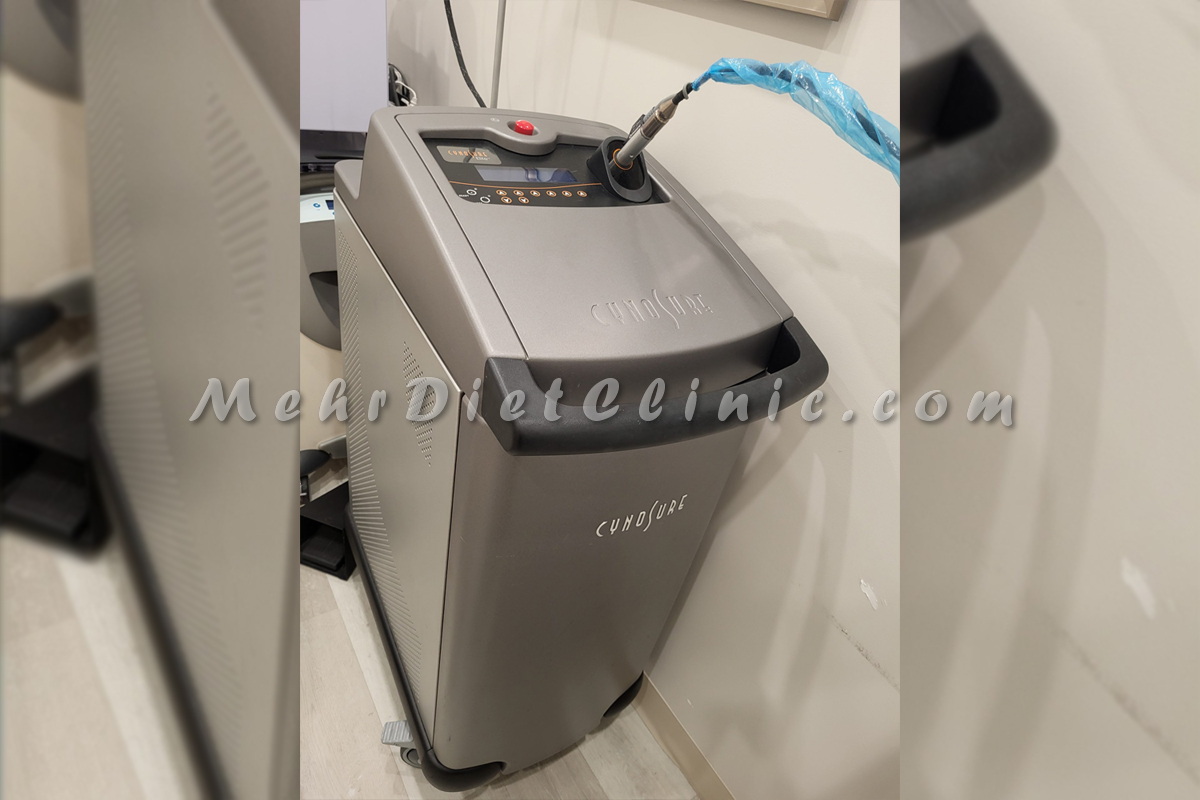 دستگاه لیزر مو های زائد شمال تهران