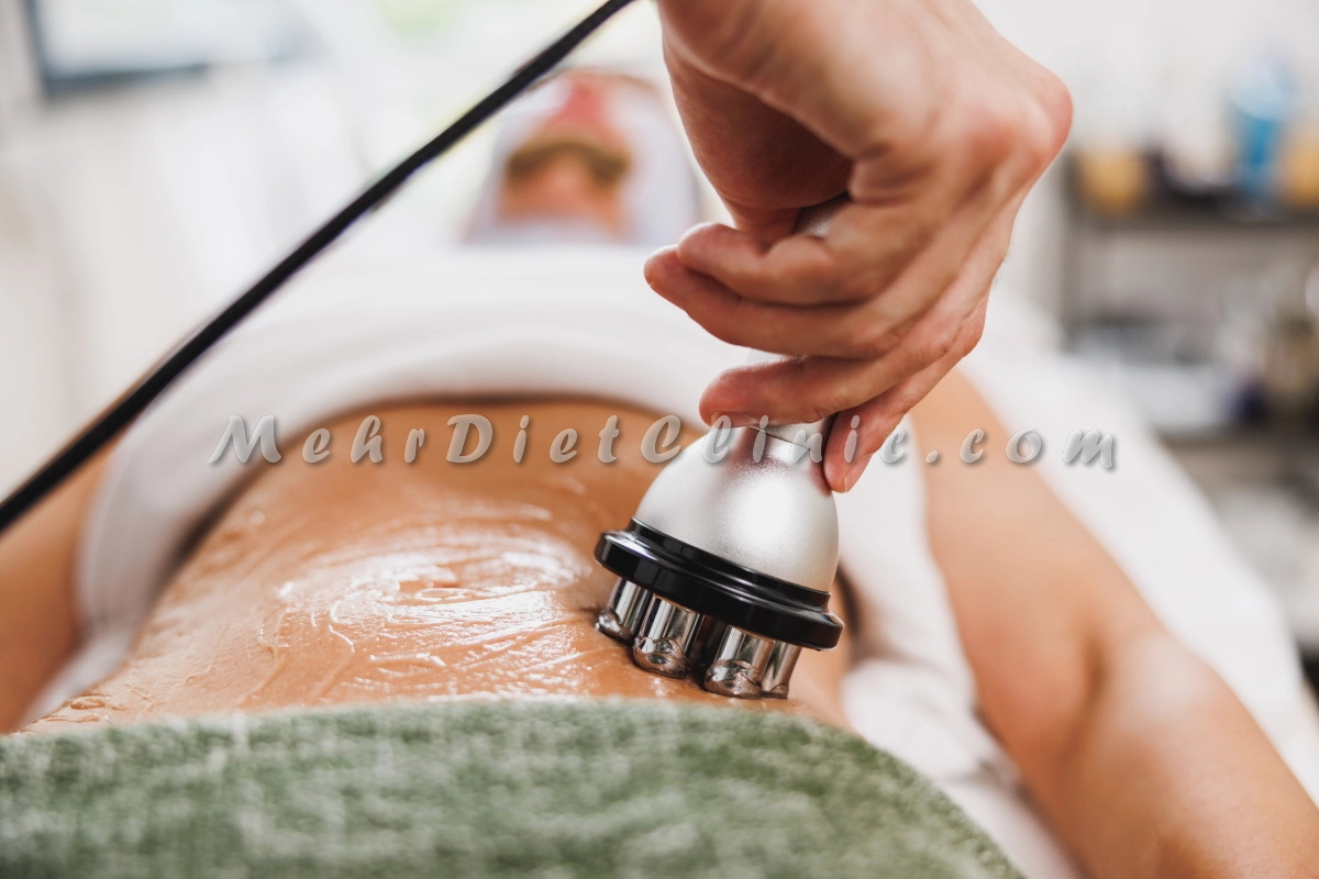 لیفت شکم با دستگاه لاغری آر اف لیفت RF