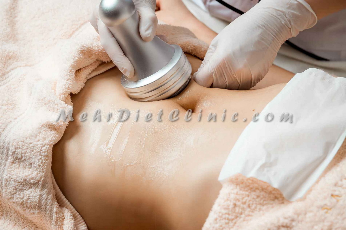 کاهش سایز موضعی با دستگاه لاغری