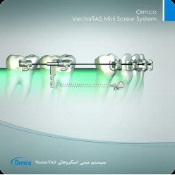 Ormco VectorTAS Mini Screw System
