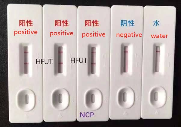 Coronavirus Ncov (COVID-19) Igg&Igm Rapid Test Kit