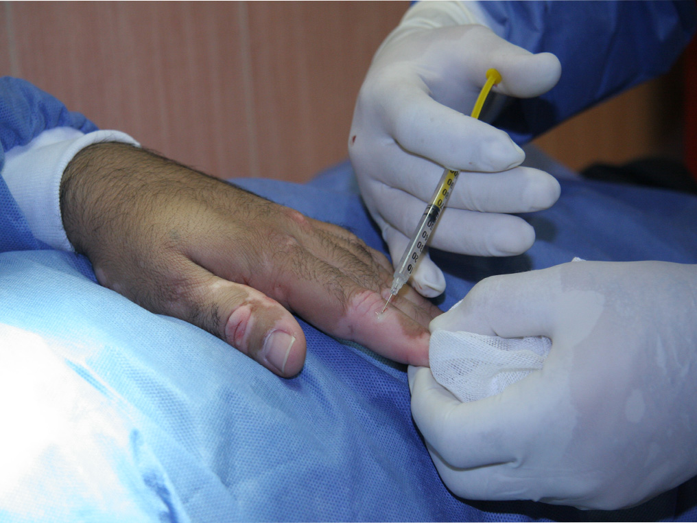 لیزر درمانی