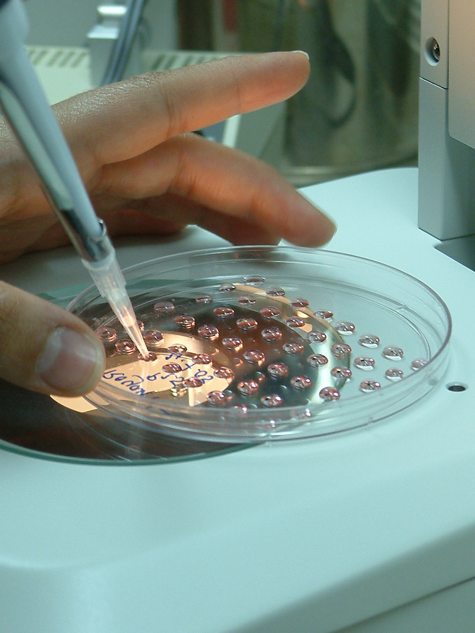 تشخیص و درمان بیماری های پستان