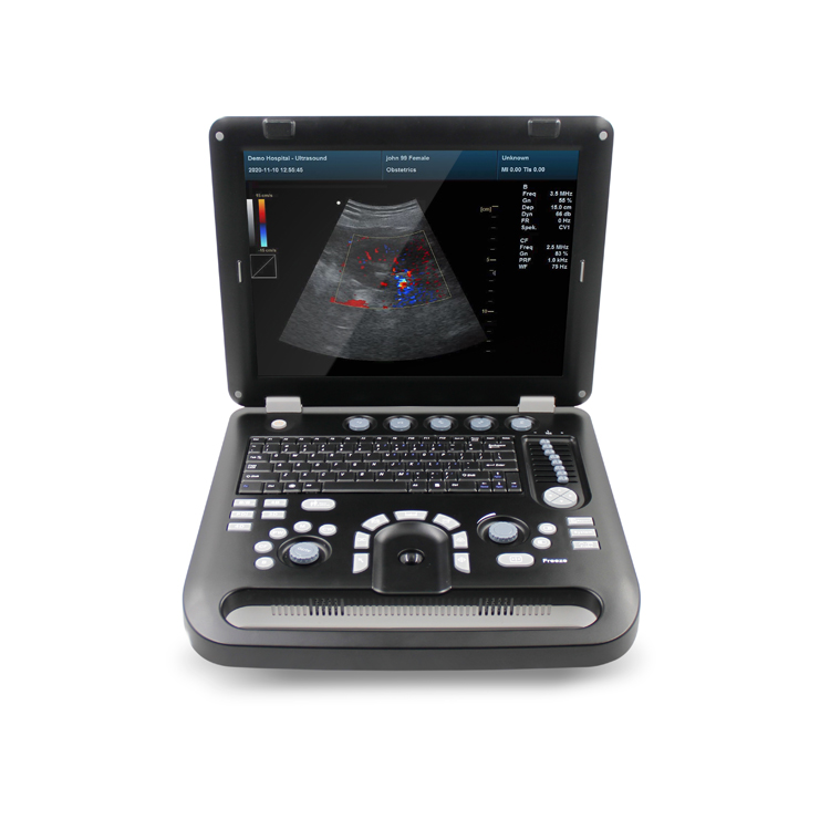 CMS1700C Color Doppler Ultrasonic Diagnostic System