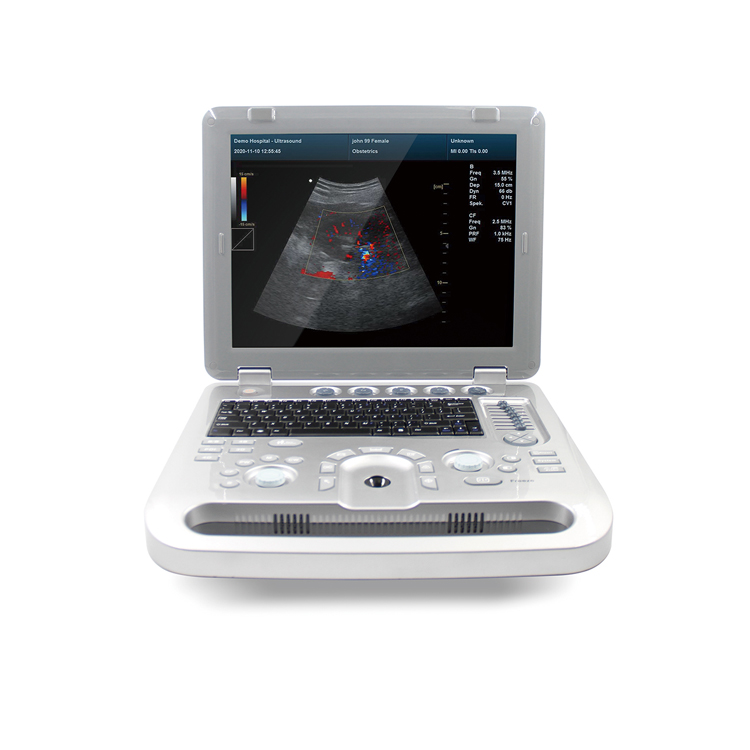 CMS1700A Color Doppler Ultrasonic Diagnostic System