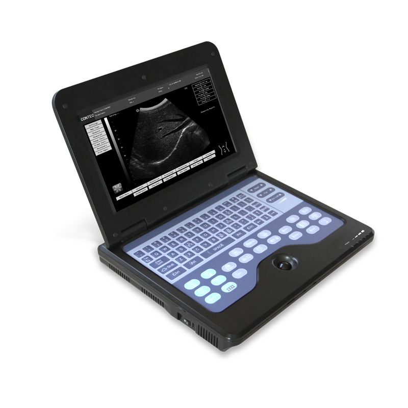 CMS600P2 B-Ultrasound Diagnostic System