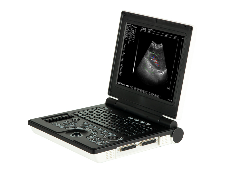 Color Doppler Ultrasound Diagnostic System
