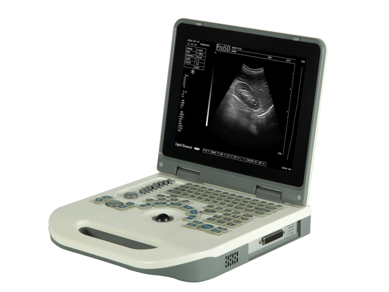 PL-3018LL Laptop Full Digital Ultrasound Scanner Diagnostic System