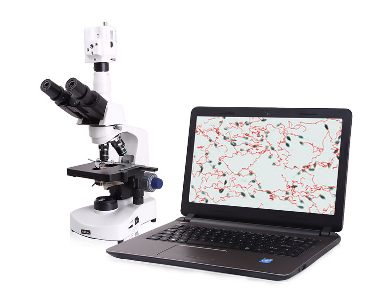 PL-6800P Veterinary Portable Ultrasound Scanner
