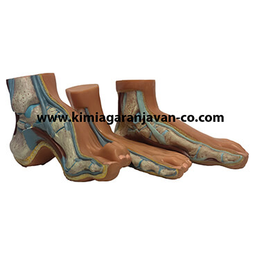 مولاژ بیماری های کف پا