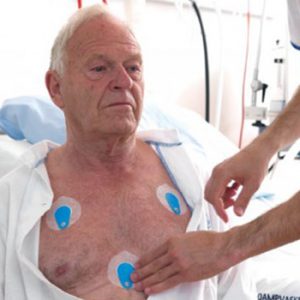 الکترود ثبت ضربان قلب ECG/EKG