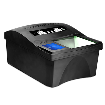 تشخیص زنده بودن اثر انگشت