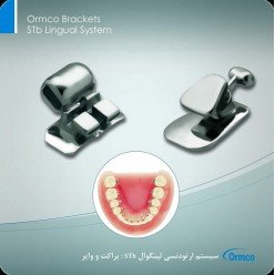 Ormco Brackets STb Lingual System