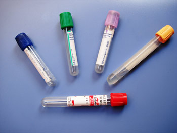 Blood collection tube