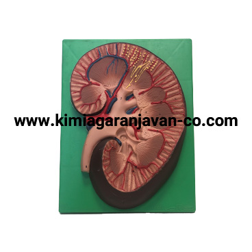 مولاژ کلیه دیواری