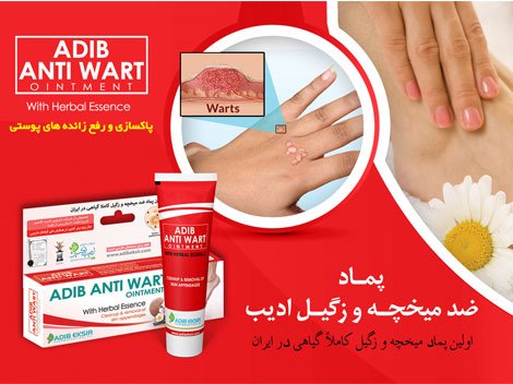 Anti-corrosion ointment and warts