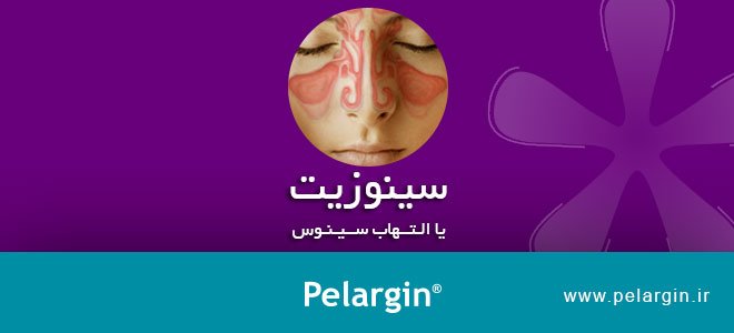 Sinusitis or sinus inflammation - polar gingival syndrome