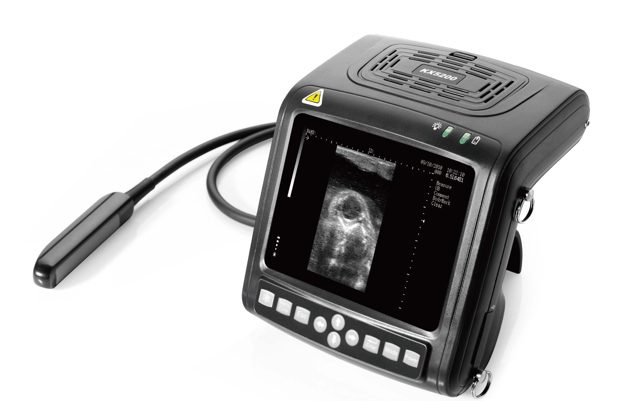 sonography KX5200